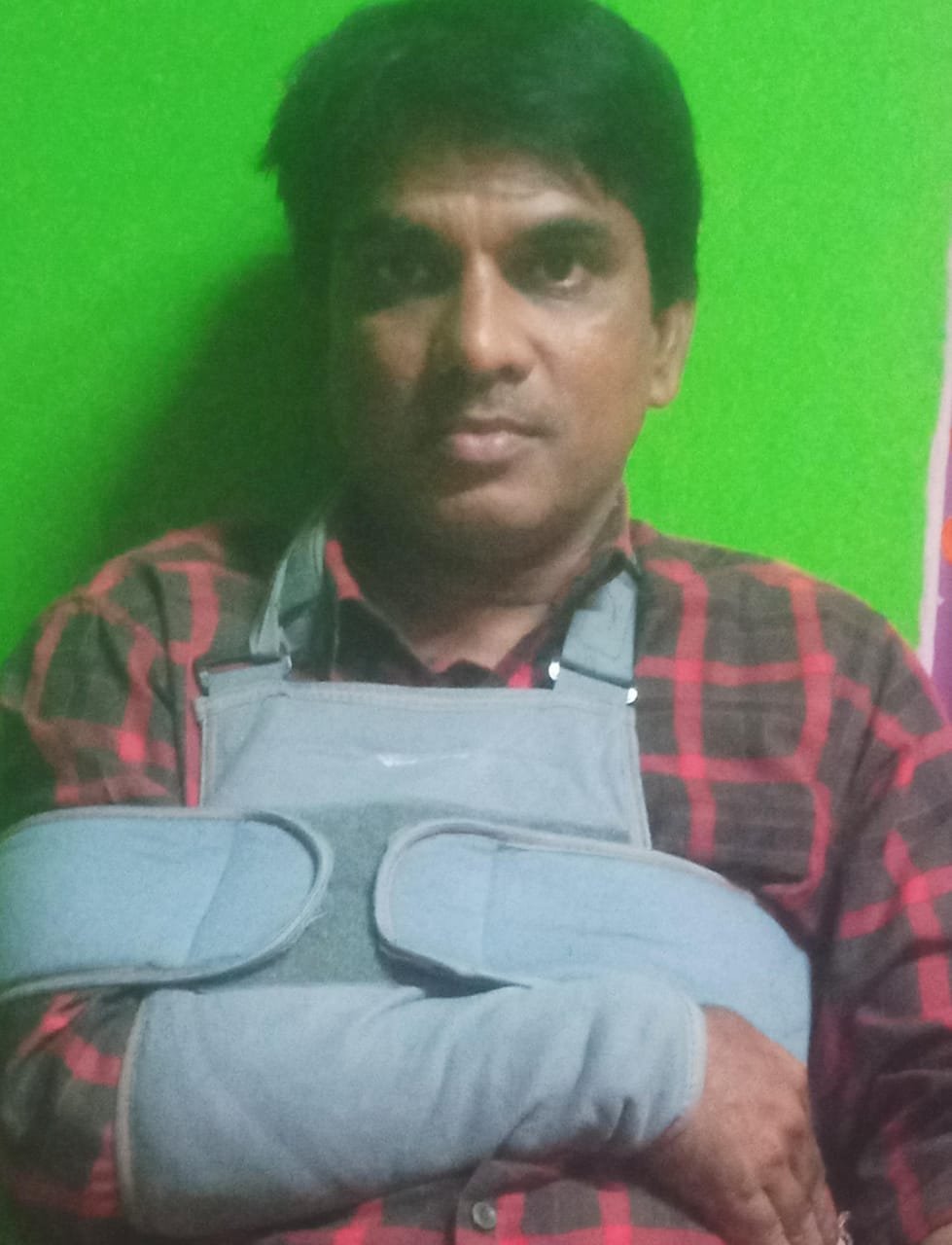 महावितरणचा अजब कारभारामुळे पत्रकार मदन मुरकर यांचा अपघात……!